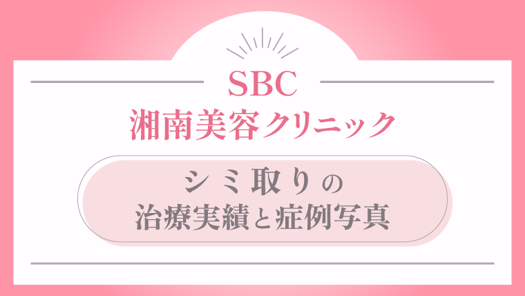 湘南美容クリニック シミ取りの特徴は？メニュー内容と値段
