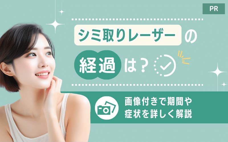 シミ取りレーザーの経過は？治療直後・3日目〜1週間後など期間別の症状まとめ