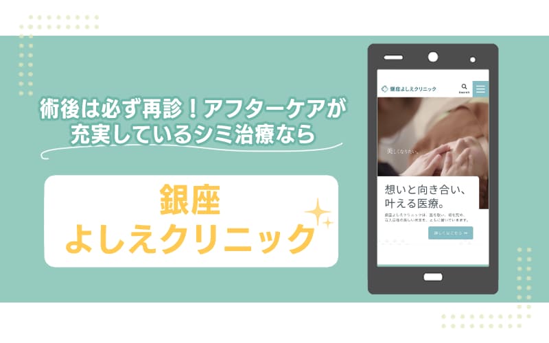 術後は必ず再診！アフターケアが充実しているシミ治療なら【銀座よしえクリニック】