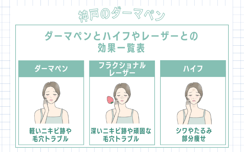 ダーマペンとハイフやレーザーとの効果一覧表!あなたの肌に合う施術はこれ