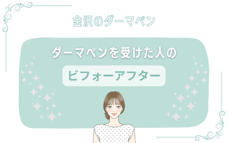 金沢でダーマペンを受けた人のビフォーアフター写真