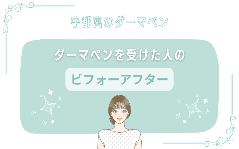 宇都宮でダーマペンを受けた人のビフォーアフター写真
