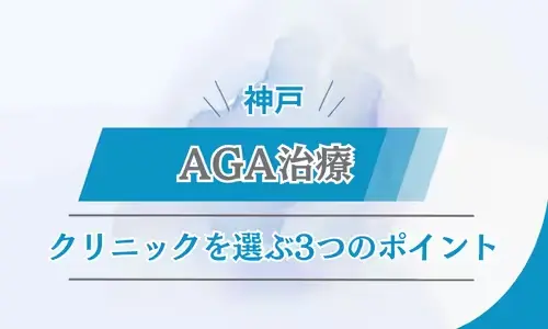 神戸　AGAクリニック　選ぶポイント