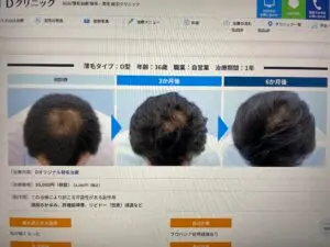 症例写真　Dクリニック