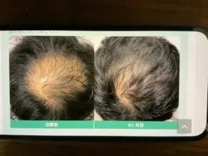 dr aga クリニック　症例写真