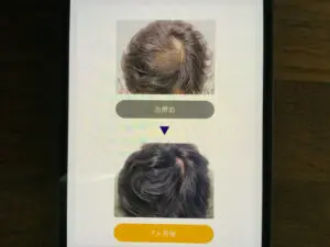 症例写真　イースト駅前クリニック