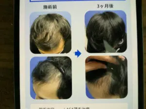症例写真　ゴリラクリニック